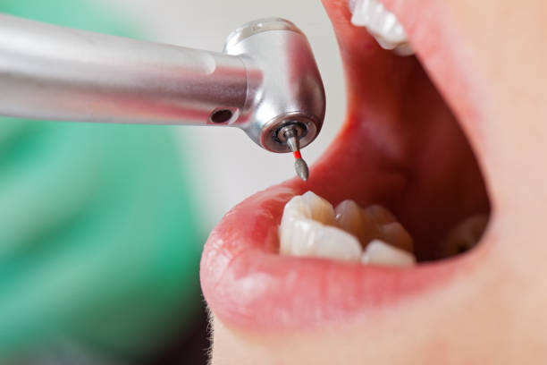 Best Emergency Treatment for Dental Infections or Abscesses in Labarque Creek, MO